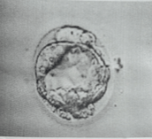 surrogacy embryo ready for transfer